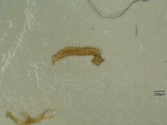 Oncopsis subangulata