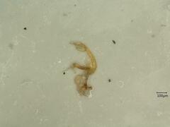 Eupteryx atropunctata