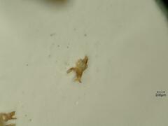 Oncopsis flavicollis