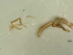 Oncopsis flavicollis