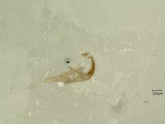 Edwardsiana prunicola