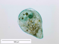 Stentor coeruleus