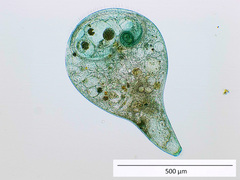 Stentor coeruleus