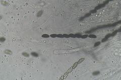 Hypoxylon rubiginosum