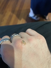 Opisthoncus parcedentatus