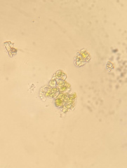 Pleurococcus
