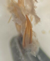 Agabus anthracinus