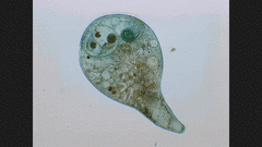 Stentor coeruleus