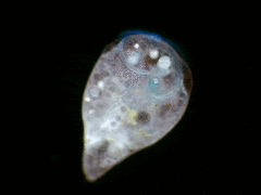 Stentor coeruleus