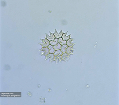 Pseudopediastrum boryanum