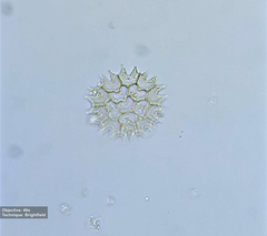 Pseudopediastrum boryanum