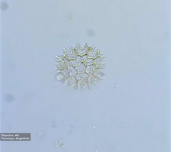 Pseudopediastrum boryanum