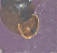 Vertigo moulinsiana