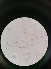 Amoebidae
