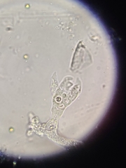 Amoebidae