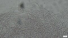 Sphaerostilbella aurifila