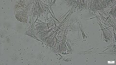 Sphaerostilbella aurifila