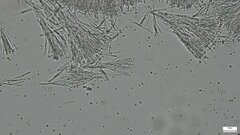 Sphaerostilbella aurifila