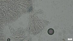 Sphaerostilbella aurifila