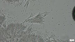 Sphaerostilbella aurifila