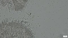 Sphaerostilbella aurifila