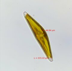 Cymbella