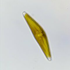 Cymbella