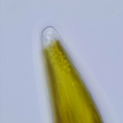 Cymbella