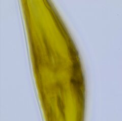 Cymbella