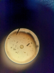 Coscinodiscophycidae