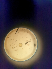 Coscinodiscophycidae