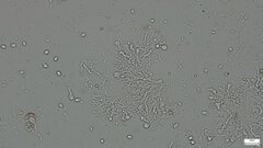 Tremellomycetes