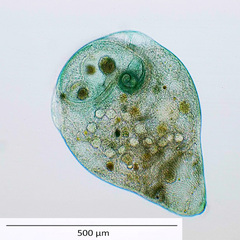 Stentor coeruleus