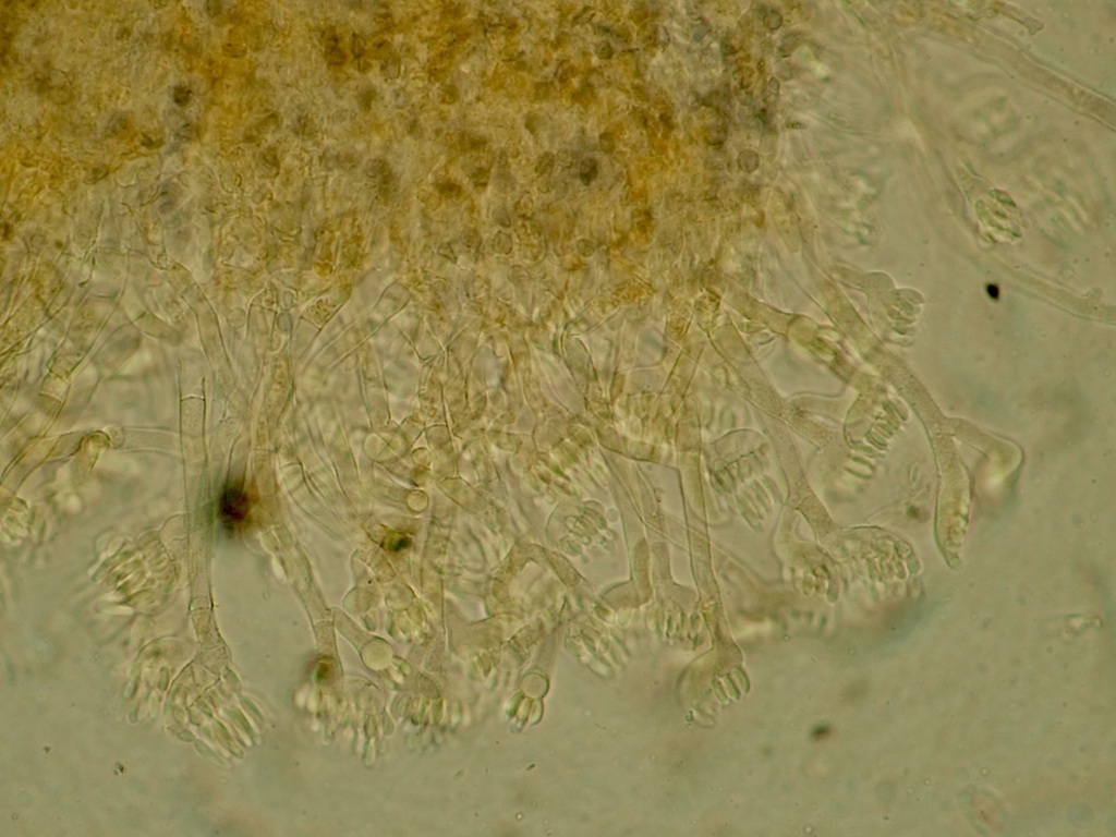 Kickxellomycota