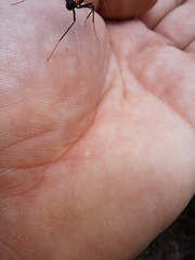 Leptomyrmex rufithorax