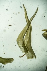 Trichodon cylindricus