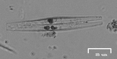 Fragilaria