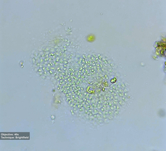 Cyanobacteria