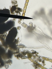 Sessilida
