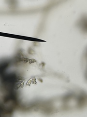 Sessilida