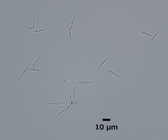 Isthmolongispora intermedia