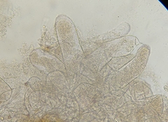 Glomeromycota