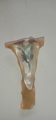 Malleus