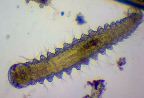 Representative image of Ophryotrocha