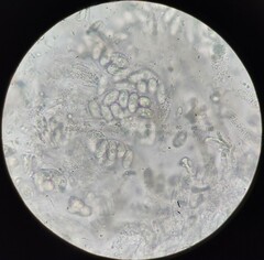 Placidium squamulosum