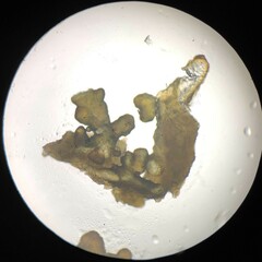 Lathagrium cristatum