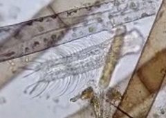 Chaetonotus