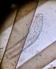 Chaetonotus