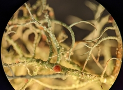 Biatoropsis usnearum