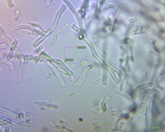 Akanthomyces